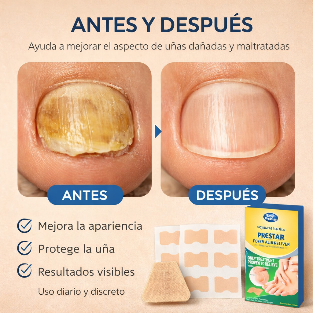 Nailzen Patch - Protección diaria para tus uñas